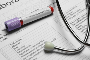 Liver function tests