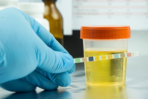 Urine Tests
