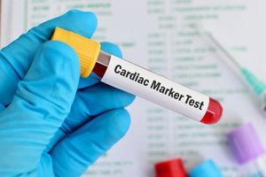 Viral Marker Tests