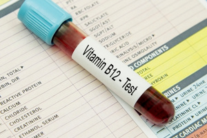 Vitamin & Bone Health Tests ​